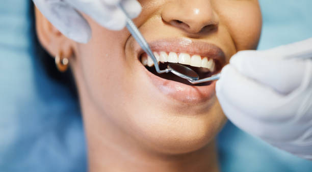 Best Emergency Dentist for Lost Fillings or Crowns in Toledo, OR